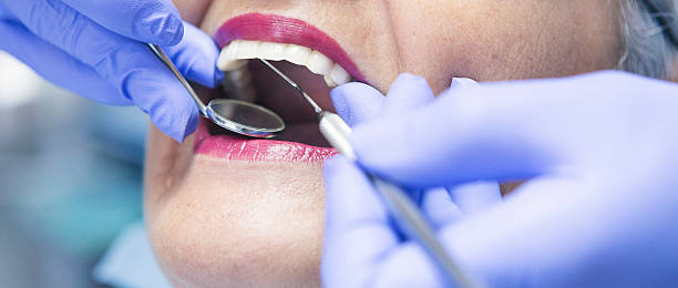 Best Emergency Broken Tooth Repair in Orange Park, FL